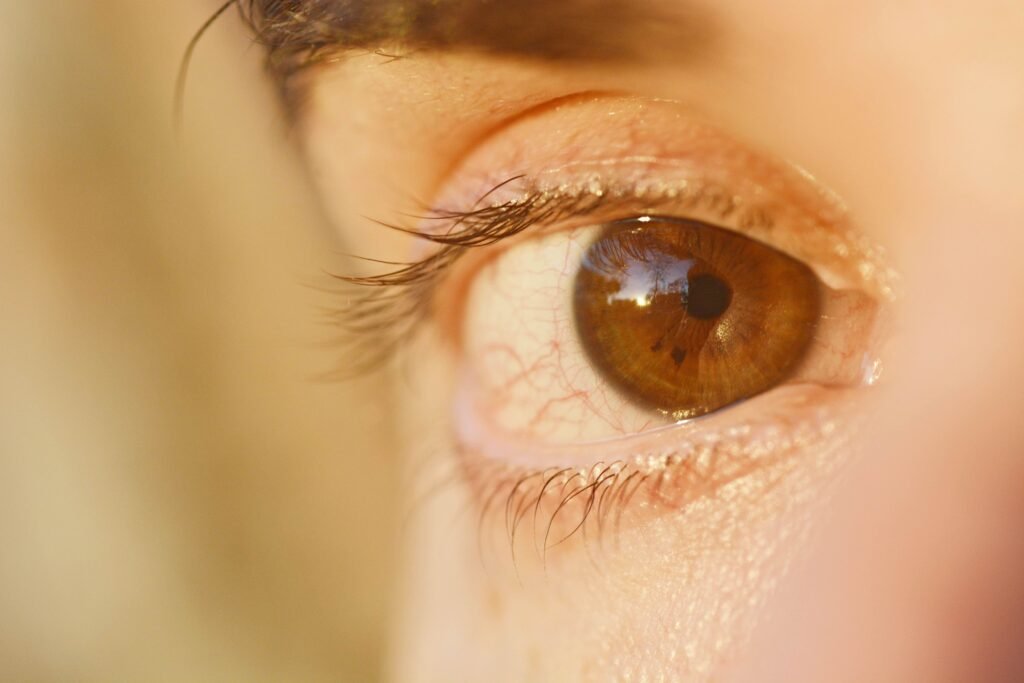 vitamin deficiency dry eyes